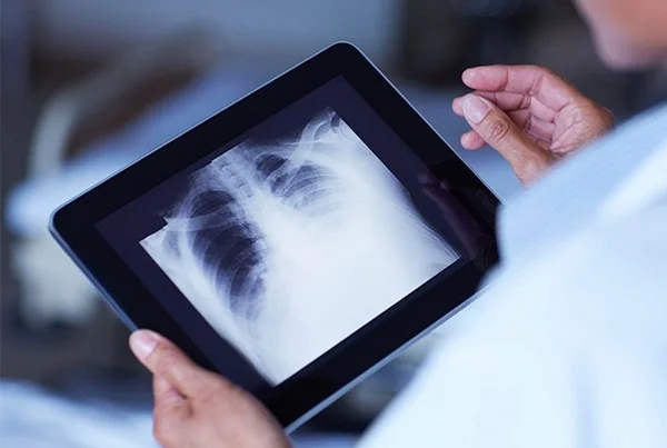 Digital X-Ray